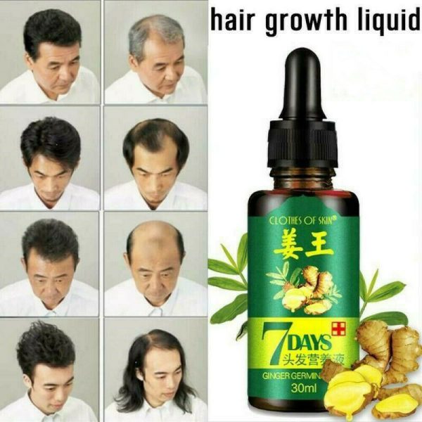 GINGER GERMINAL OIL for fast hair growth (original)