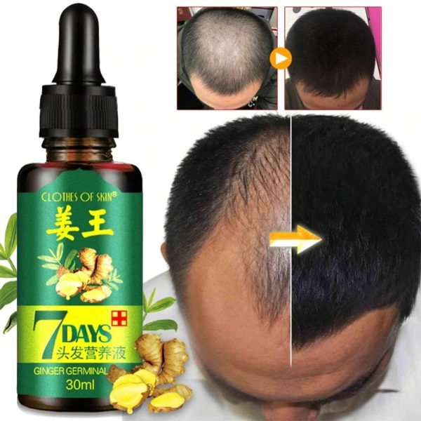 GINGER GERMINAL OIL for fast hair growth (original)