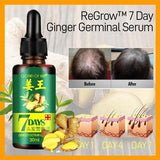 GINGER GERMINAL OIL for fast hair growth (original)