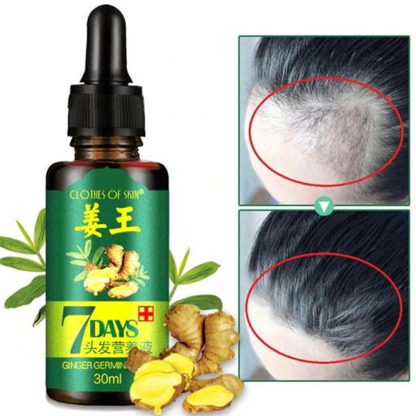 GINGER GERMINAL OIL for fast hair growth (original)