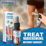Varicose Veins Treatment Spray – Advanced Formula for Spider Veins, Leg Pain & Swelling Relief ~ 30ml