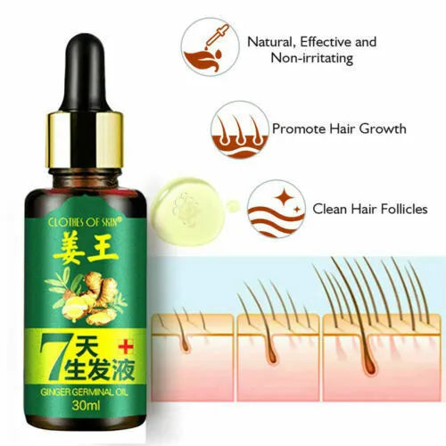 GINGER GERMINAL OIL for fast hair growth (original)